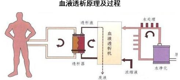 血液透析原理及过程