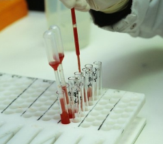 2020年中国抗体检测行业主要原理及检测试剂盒批准数量「图」