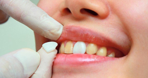 牙齿美容行业发展现状及趋势分析，大型连锁化趋势明显「图」