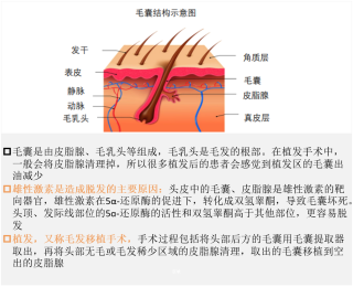 中国医疗美容行业专题文章之八：脱发人群年轻化，植发需求旺盛「图」