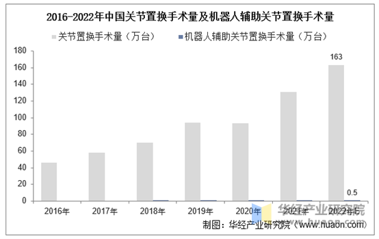 关节置换